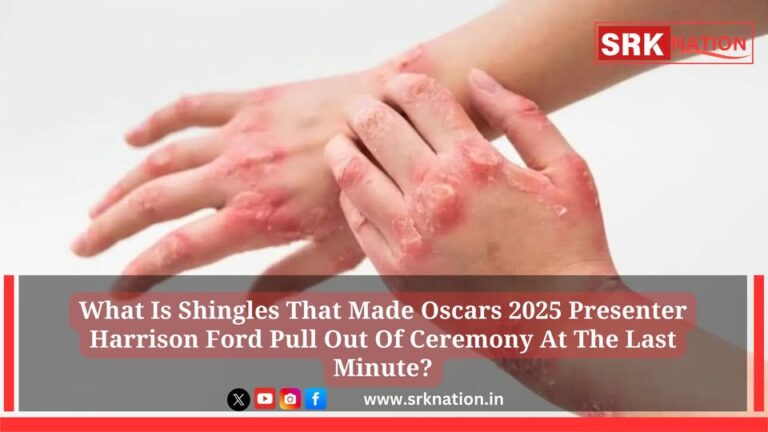 What Is Shingles That Made Oscars 2025 Presenter Harrison Ford Pull Out Of Ceremony At The Last Minute?