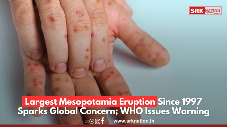 Largest Mesopotamia Eruption Since 1997 Sparks Global Concern; WHO Issues Warning