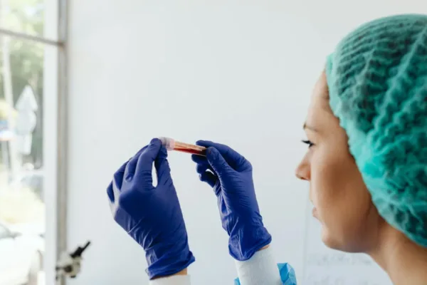 Africa Scales Up Hantavirus Surveillance Following Recent Exposure Concerns