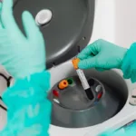 Breakthrough Blood Test Predicts Lung Cancer Five Years Before Diagnosis