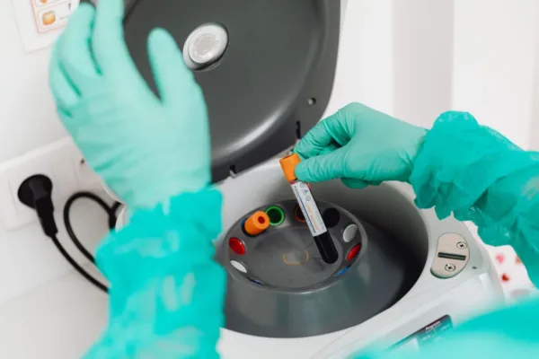 Breakthrough Blood Test Predicts Lung Cancer Five Years Before Diagnosis