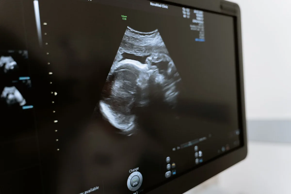 Hidden Heart Changes May Serve as Early Warning Signs for Cancer