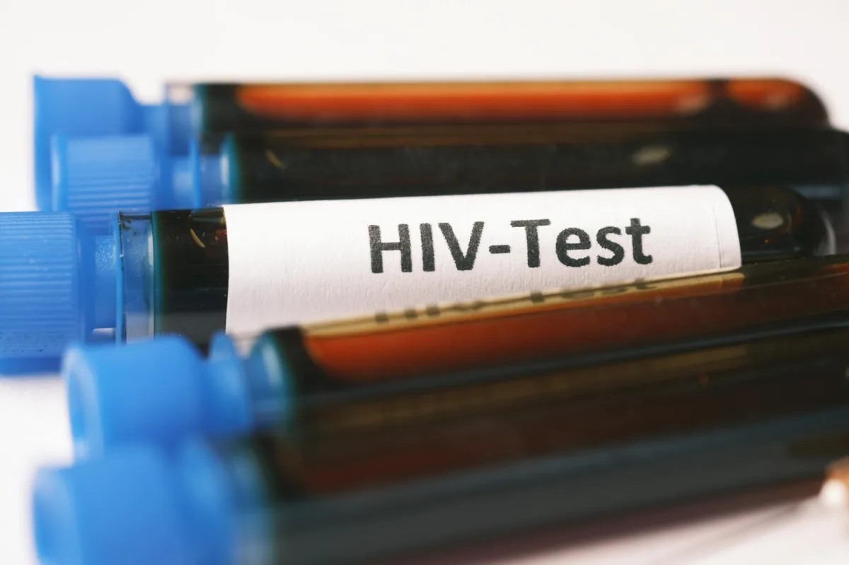 Karnataka Faces Rising HIV/AIDS Surge Driven by Changing Transmission Trends