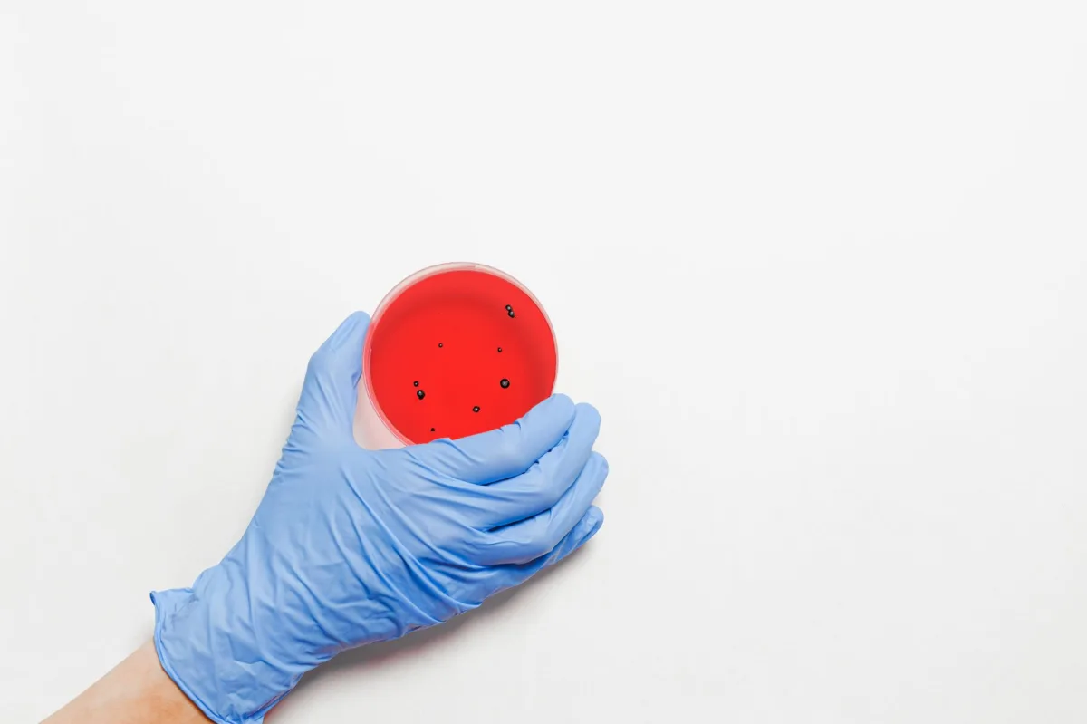 The Silent Pandemic: Unpacking the Global Surge in Antimicrobial Resistance