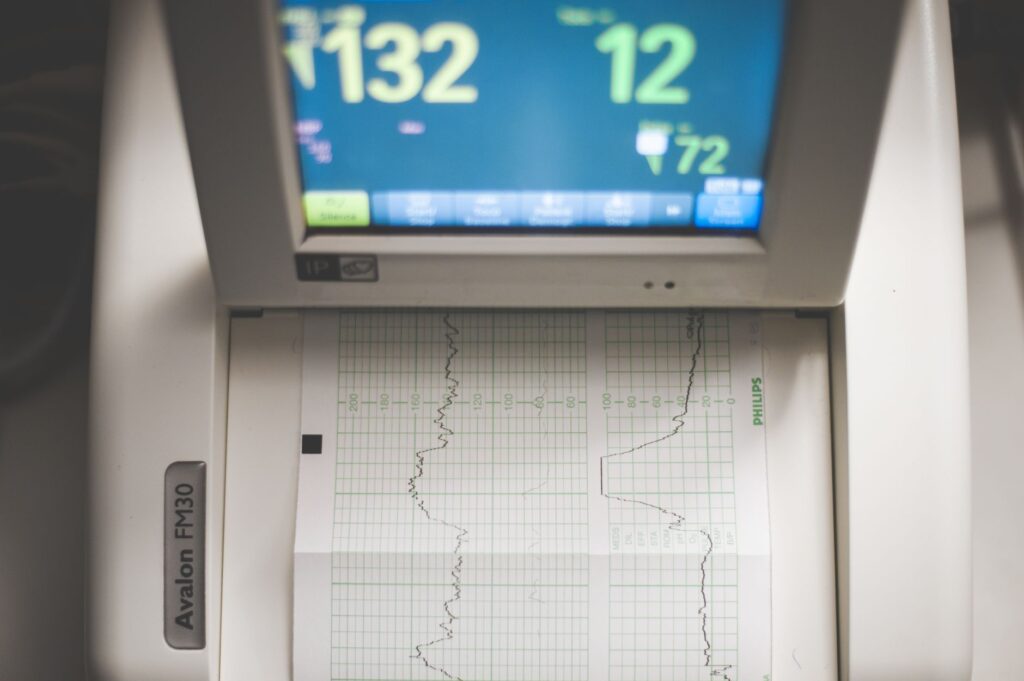 ECG monitor with screen showing medical data, focusing on heart rate and diagnostic results.