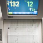 ECG monitor with screen showing medical data, focusing on heart rate and diagnostic results.